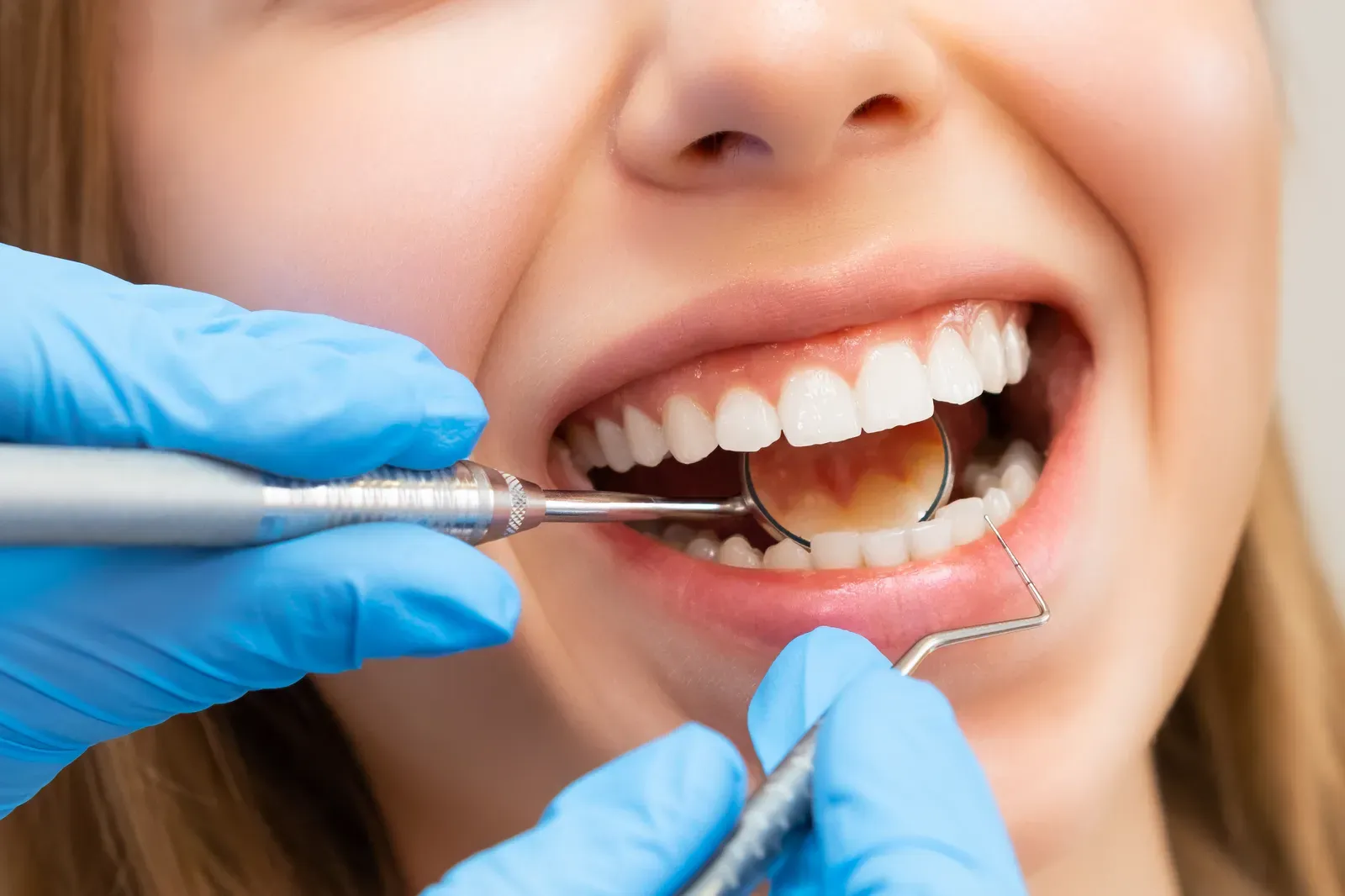 Gum Disease 101: Warning Signs and Expert Advice