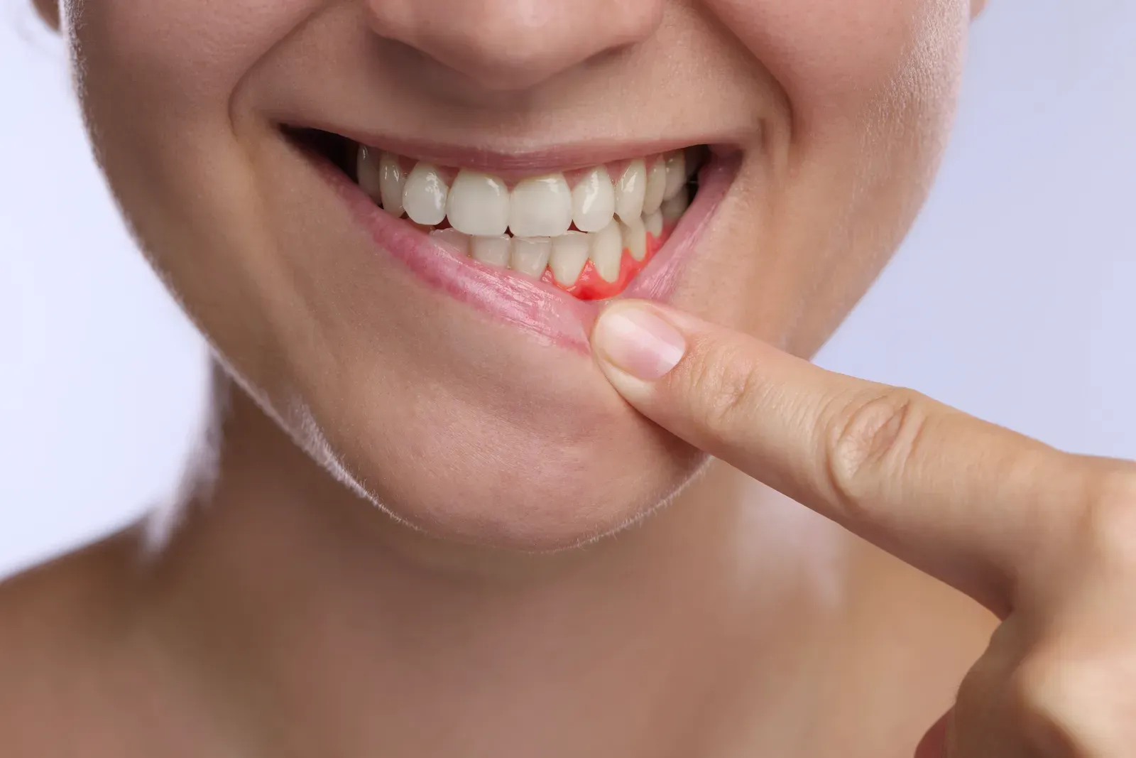 Gum Disease Warning Signs You Shouldn't Ignore