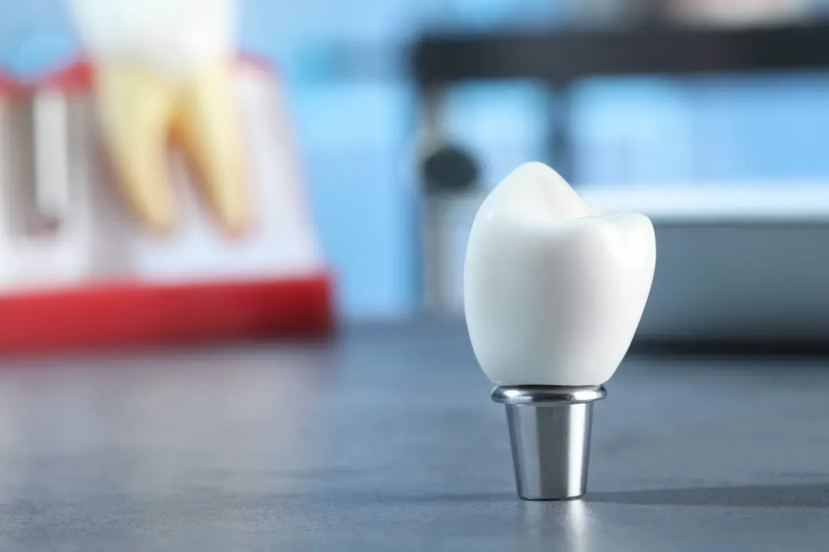 Dental Crowns vs. Fillings: Which Fits Your Tooth?