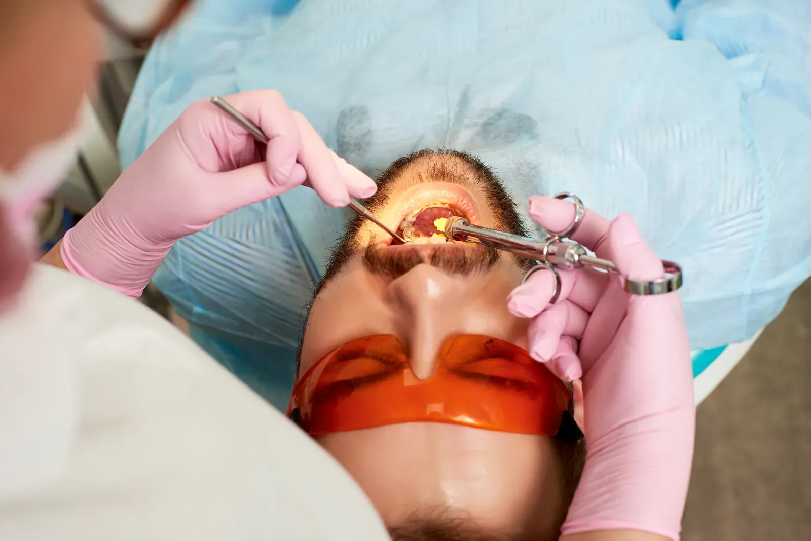 Photo related to tooth extractions